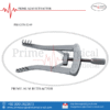 ALM RETRACTOR